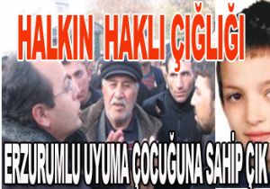 ERZURUMLU BURNUNDAN SOLUYOR!