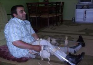 Son çare Bakan Akdağ